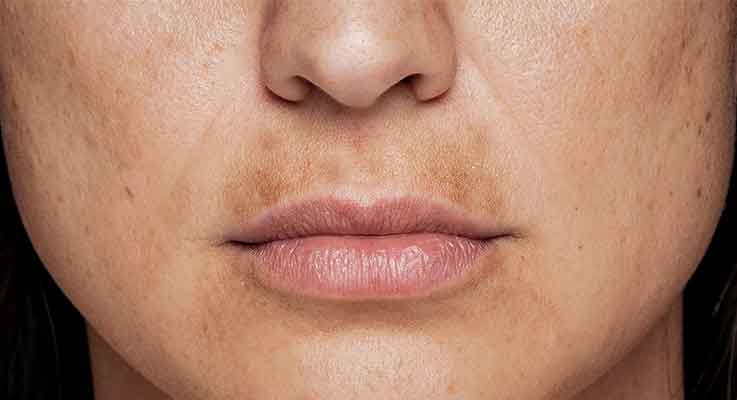 Dr. Charlotte Grillitsch - Med and Skin 